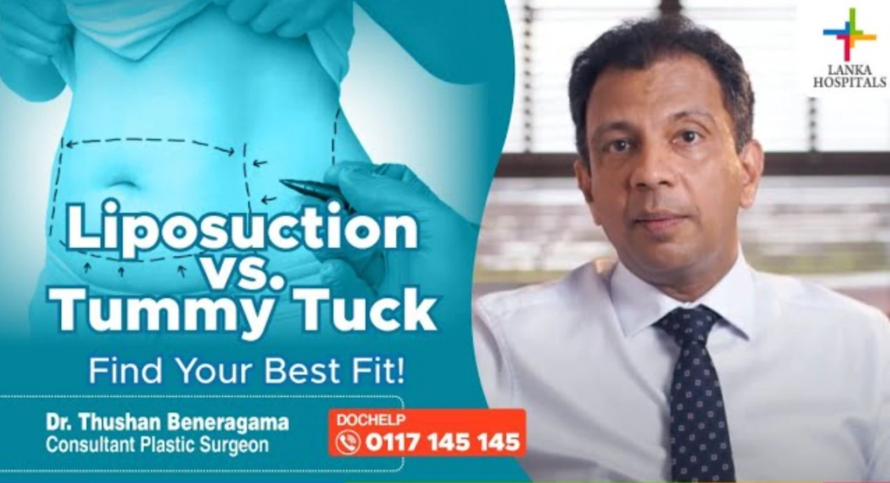 Liposuction – Dr. Thushan Beneragama